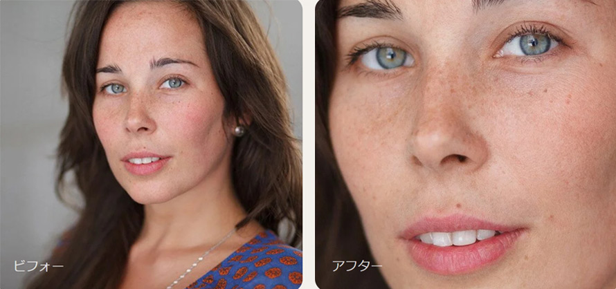 ��̏��Ղ��������@�A Retouch4me �V���[�Y